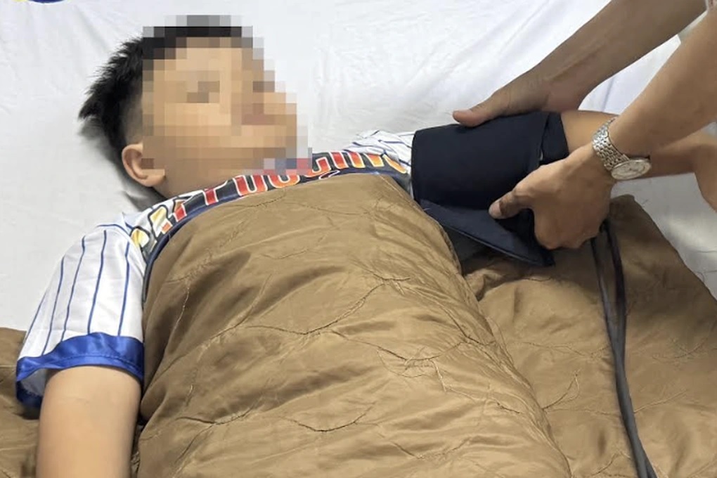 Hai bệnh nhi ngộ độc sau khi nuốt phải mủ hoa sứ