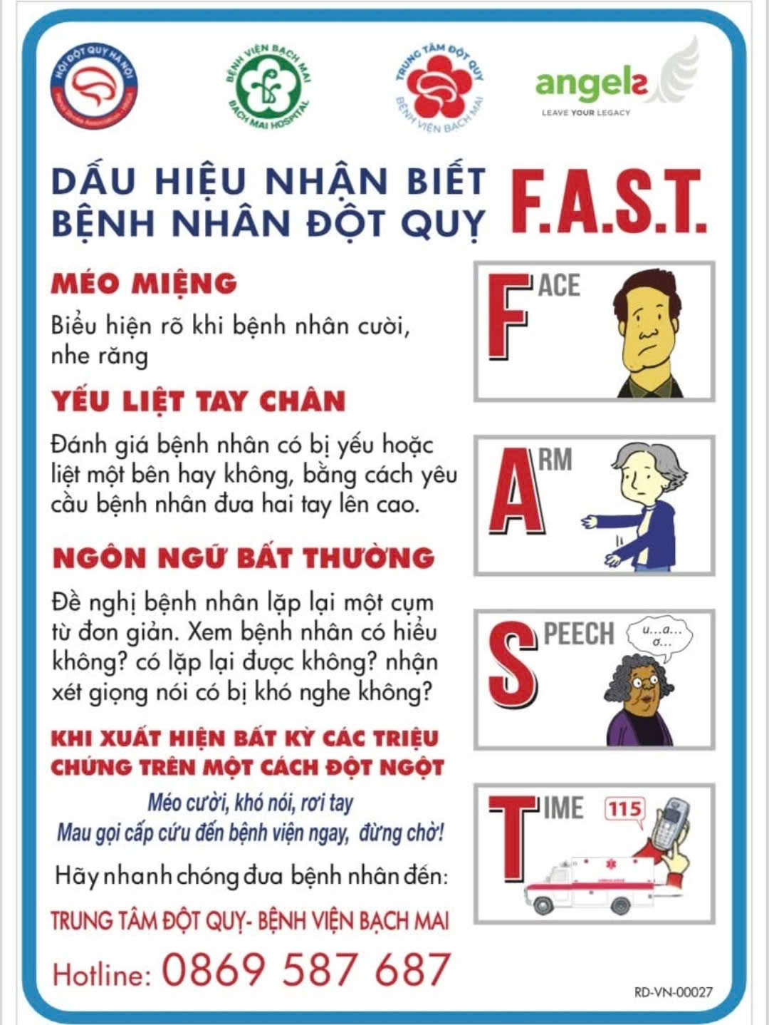 Chuyên gia cảnh báo dấu hiệu mờ nhạt trước cơn đột quỵ, cần biết để an toàn