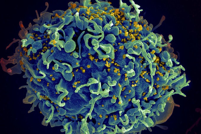 Những virus nguy hiểm nhất thế giới