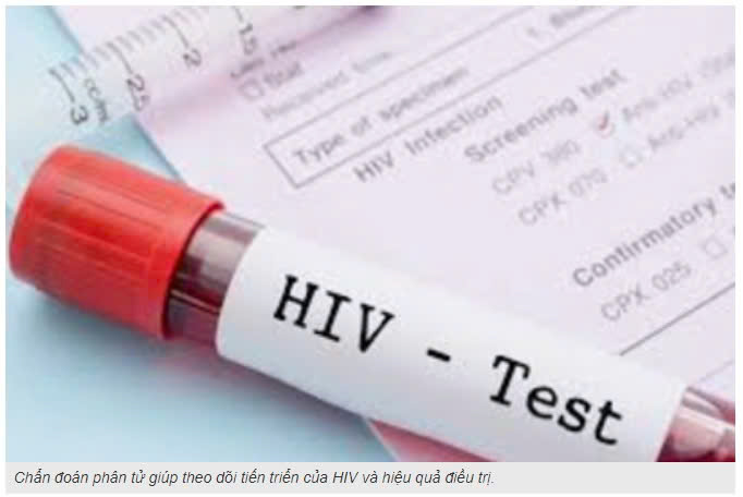 Vai trò của chẩn đoán phân tử trong theo dõi điều trị HIV Vai trò của chẩn đoán phân tử trong theo dõi điều trị HIV