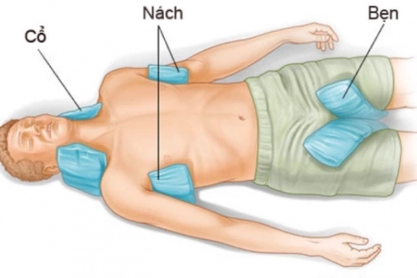 4 bước sơ cứu say nắng, sốc nhiệt đơn giản