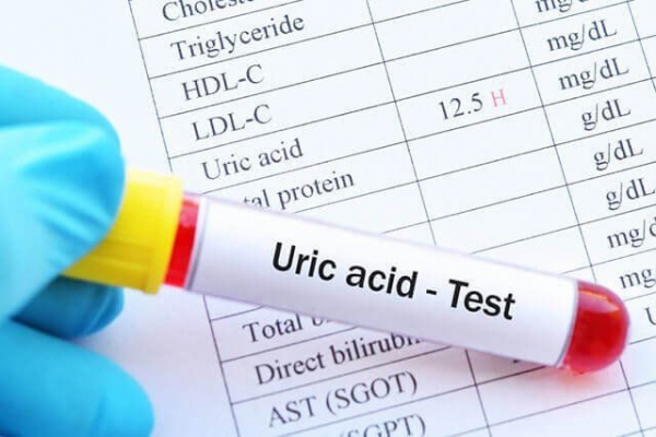 5 bệnh có thể làm tăng acid uric