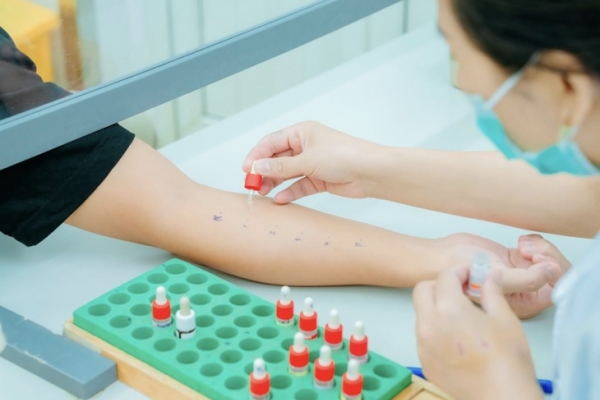 Dị ứng thức ăn và thuốc: Sai lầm từ thói quen tự chẩn đoán