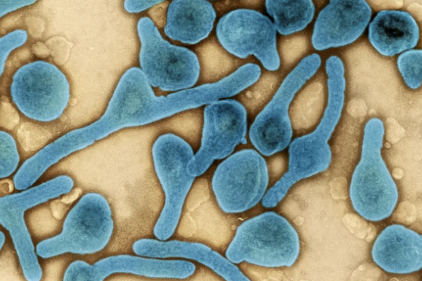 Những điều cần biết về virus Marburg gây bệnh sốt xuất huyết