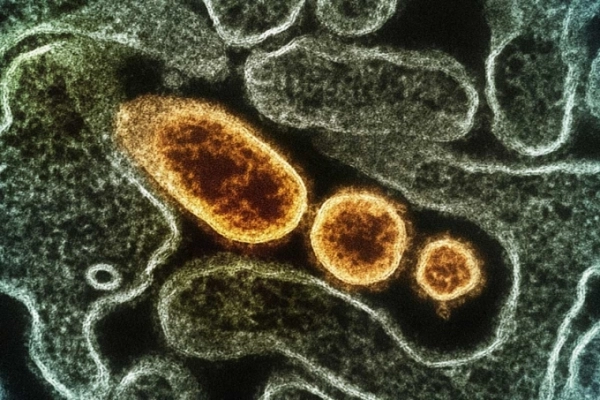 Vaccine phòng virus Nipah tiếp tục thử nghiệm trên người
