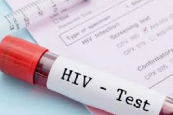 Vai trò của chẩn đoán phân tử trong theo dõi điều trị HIV