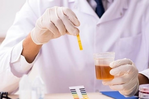 Xét nghiệm nước tiểu và ý nghĩa của các chỉ số